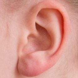 Blog 58: Those Terrible Earaches!