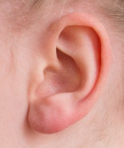 Blog 58: Those Terrible Earaches!