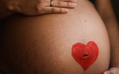 Blog 271 Pregnancy Stretch Marks: What to Expect and How to Care for Your Skin