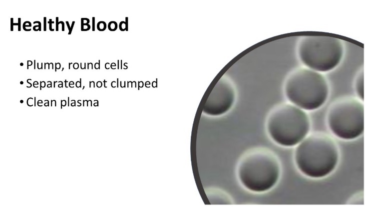 Blog 276 Healthy Blood: Understanding Blood Analysis with Guest Expert Julie Formby.